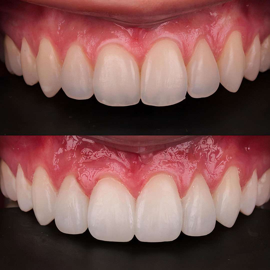 Dental Care Near Me