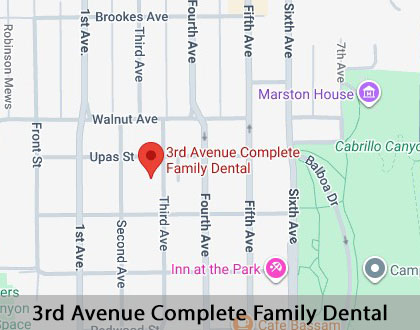 Map image for Options for Replacing Missing Teeth in San Diego, CA