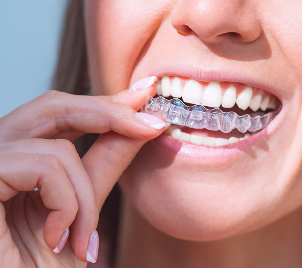 San Diego Invisalign